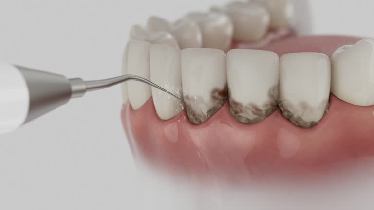 Reliable Dental Implants contractor in Hayti, PA by Smile Center Dentistry